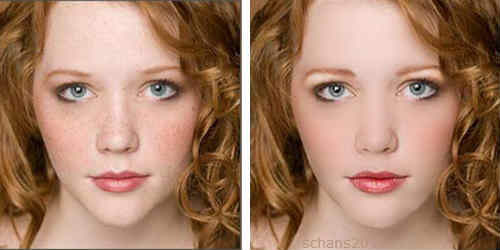 до и после фотомоложения
