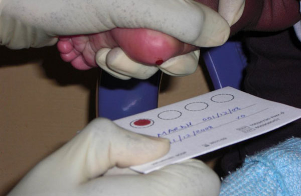 сдать анализ крови на туберкулез